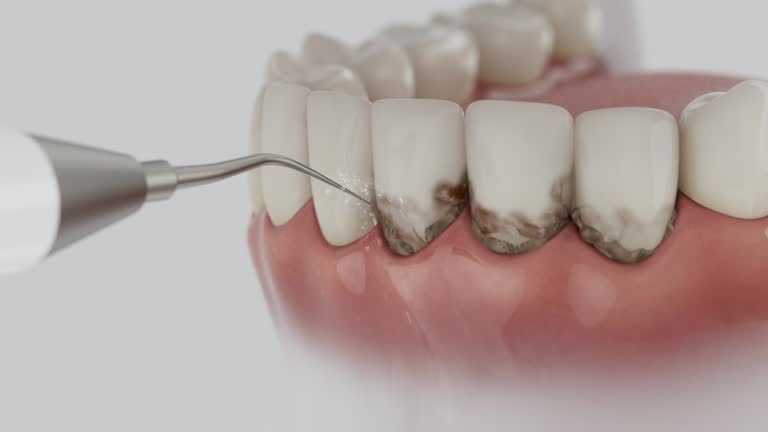 Reliable Emergency Dentist contractor in Grayson, CA by Smile Center Dentistry